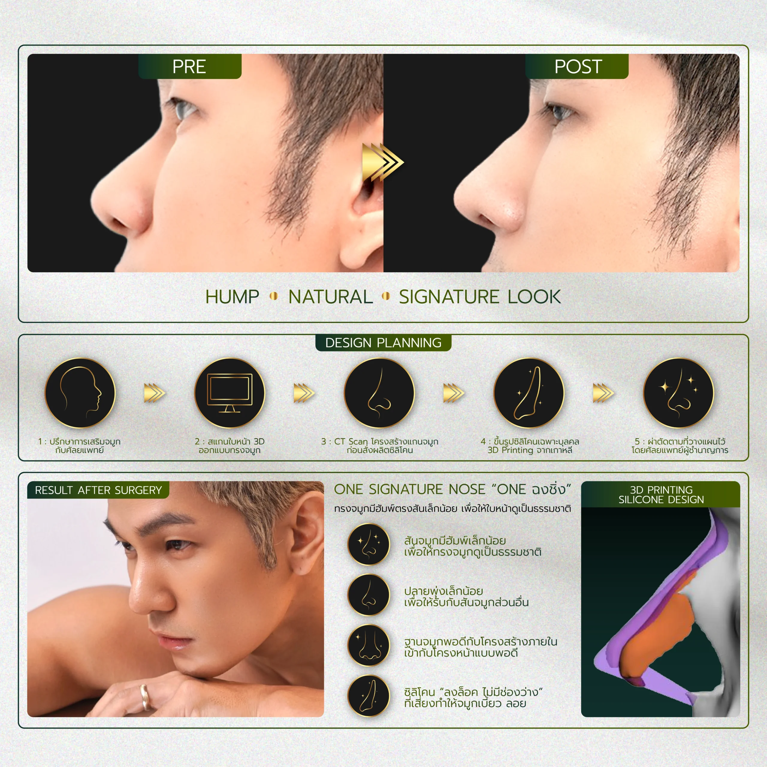 INFO-รวมจมูก-Website-01_32-scaled.webp