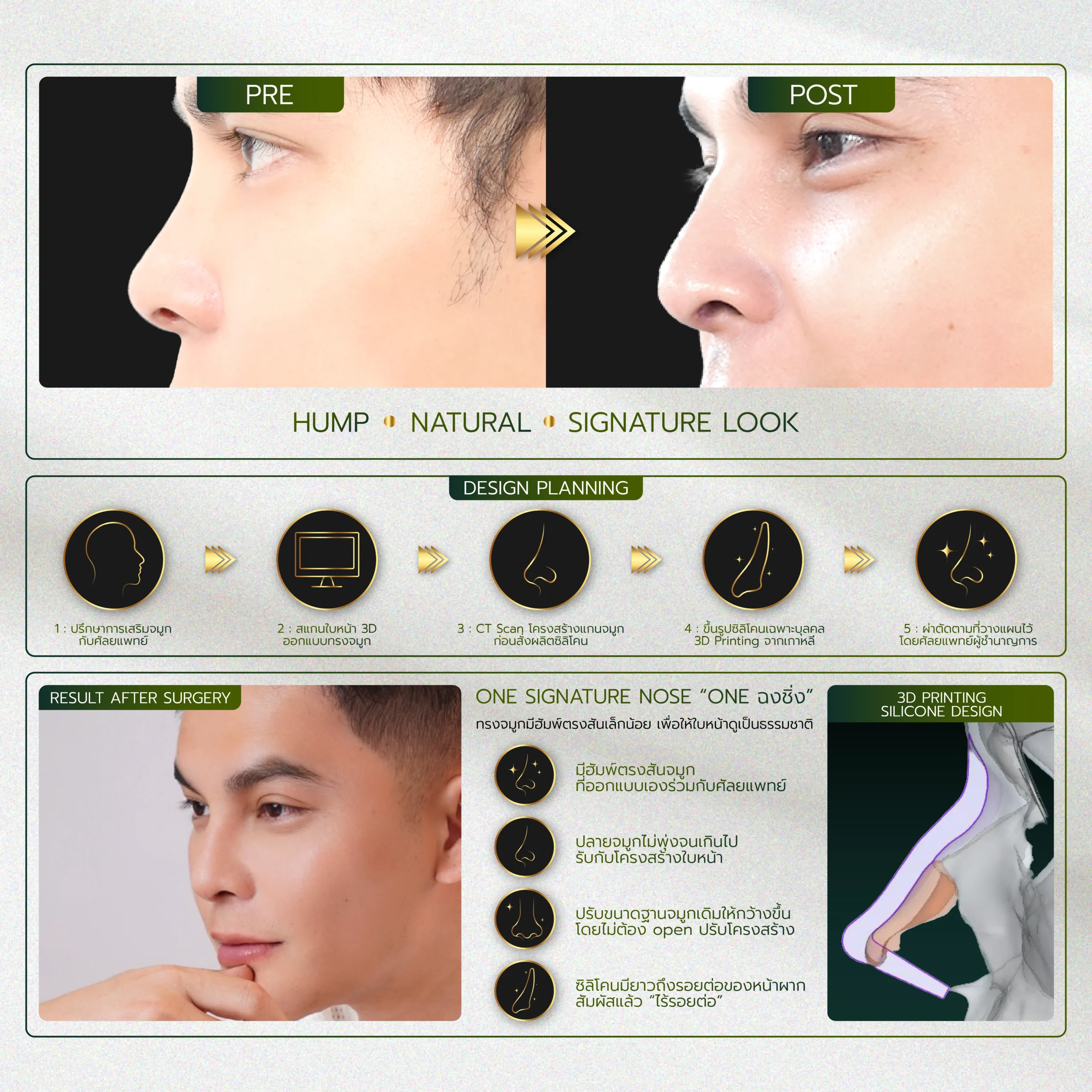 INFO-รวมจมูก-Website-02_31-scaled.webp