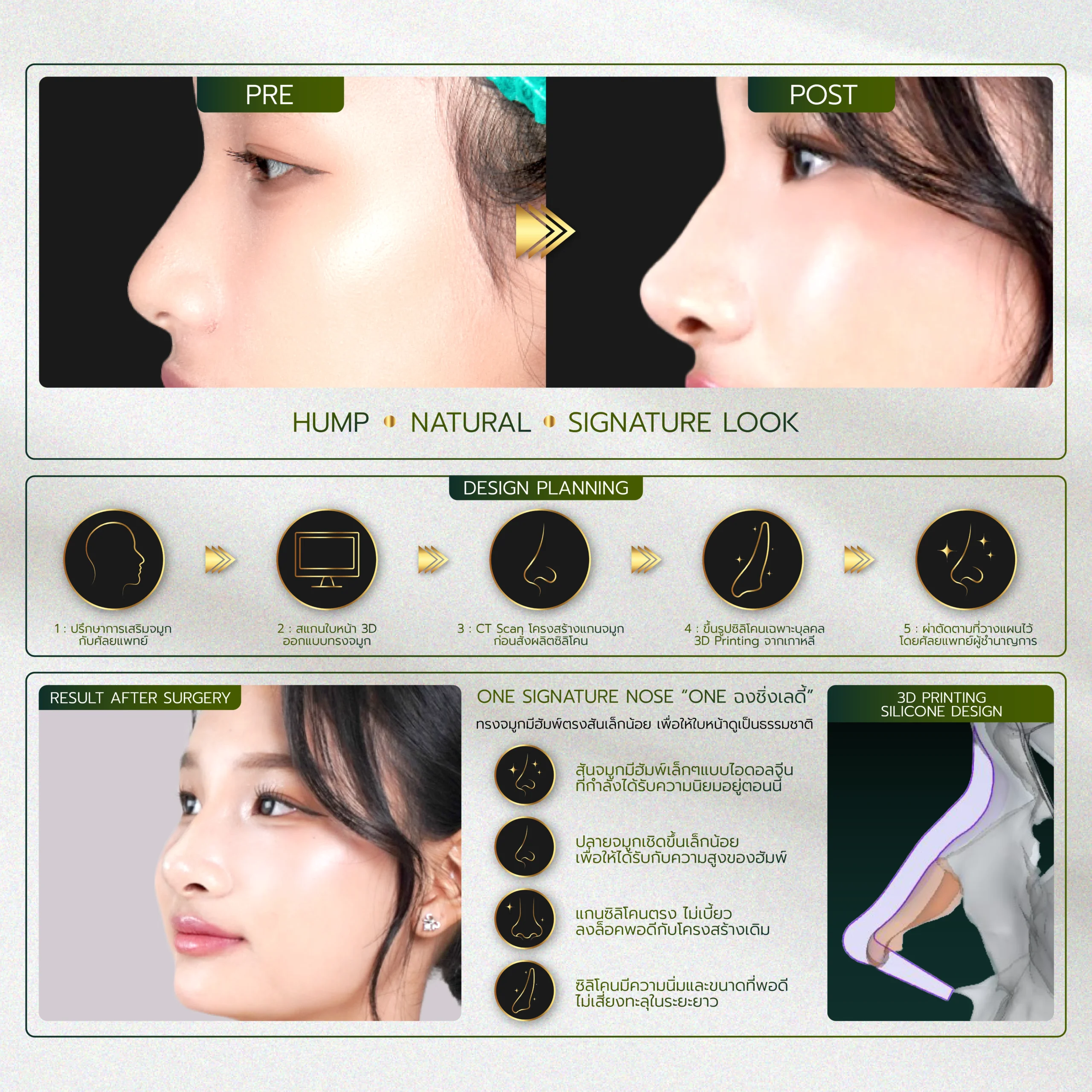 INFO-รวมจมูก-Website-03_30-scaled.webp