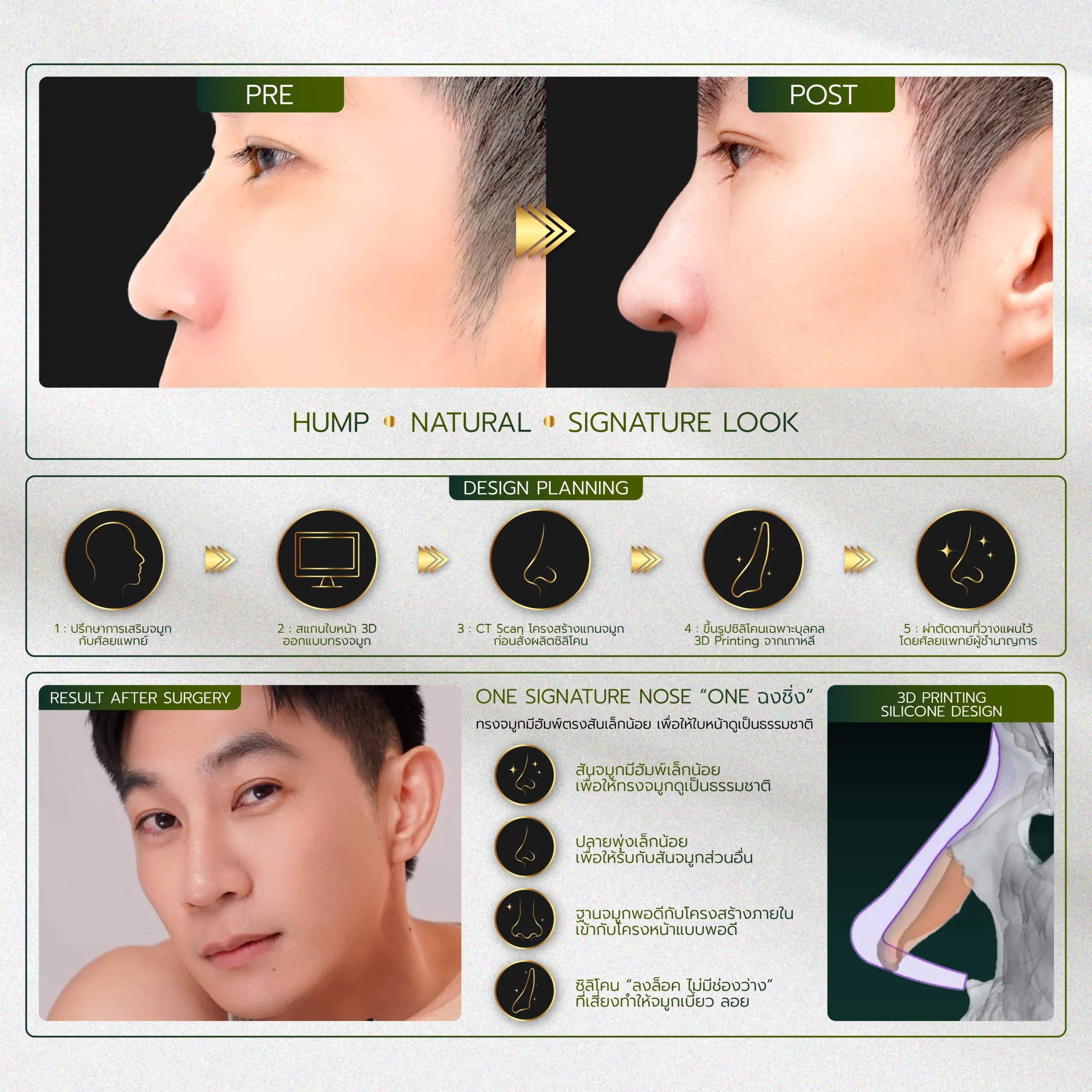 INFO-รวมจมูก-Website-04_29-scaled.webp
