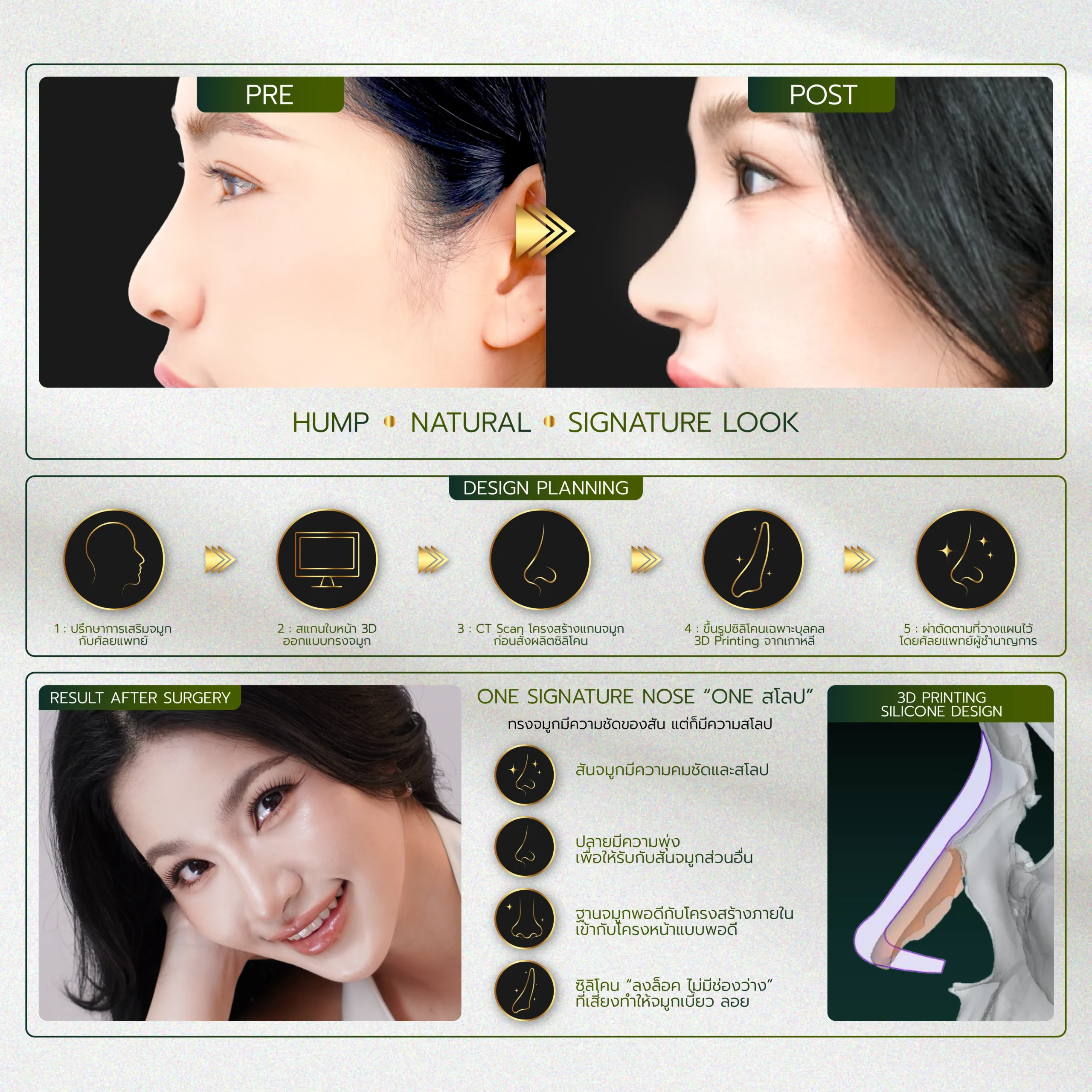 INFO-รวมจมูก-Website-05_28-scaled.webp