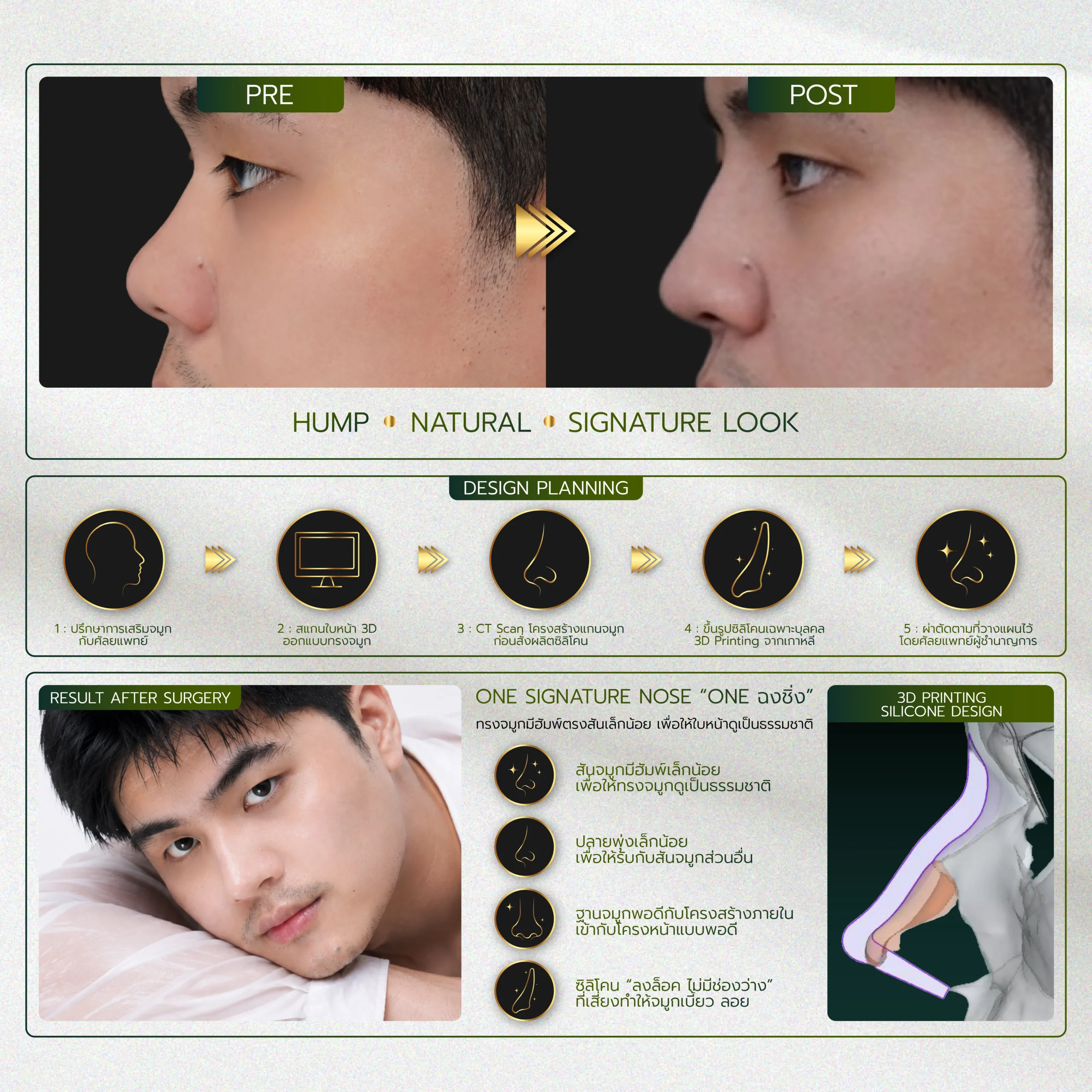 INFO-รวมจมูก-Website-06_27-scaled.webp