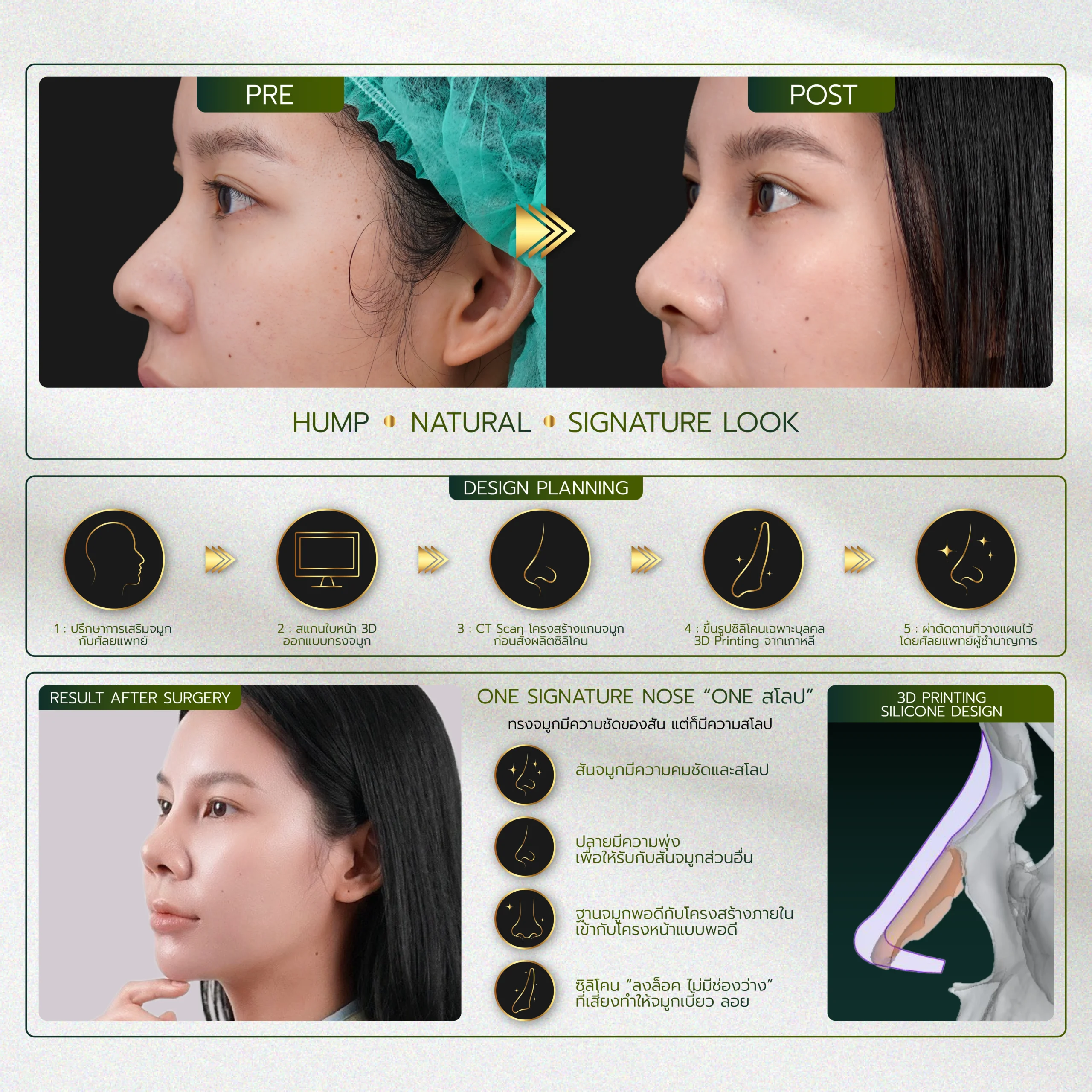 INFO-รวมจมูก-Website-07_26-scaled.webp