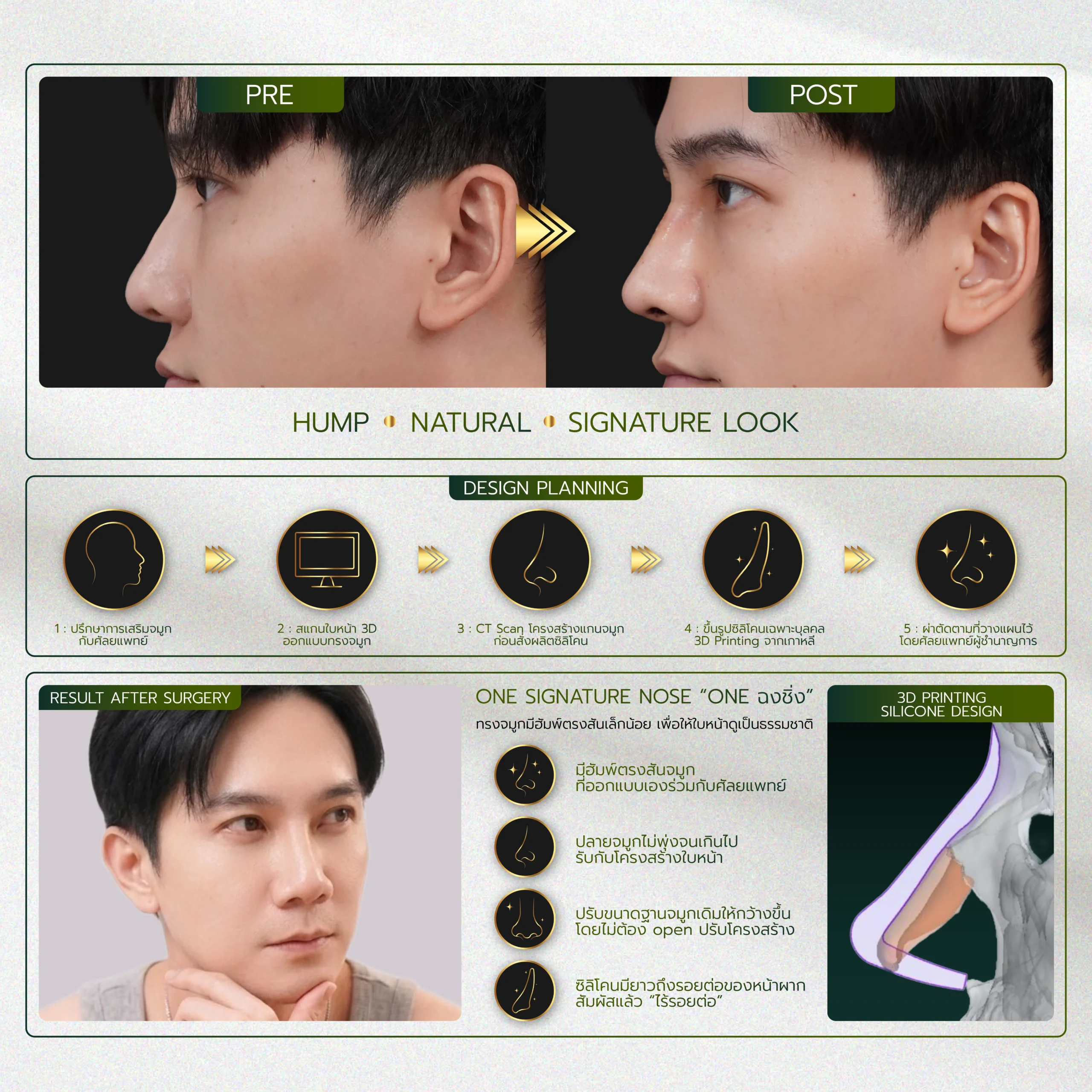 INFO-รวมจมูก-Website-08_25-scaled.webp